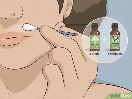 Image titled Naturally Remove Hair from Your Face Step 5