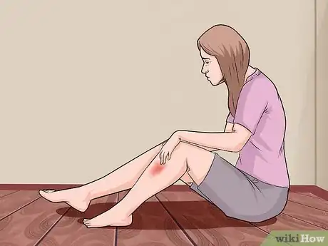 Image titled Detect a Blood Clot in the Leg Step 2