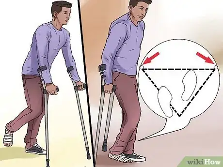 Image titled Walk on Crutches Step 10