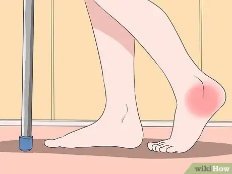 Image titled Relieve Heel Pain Step 2