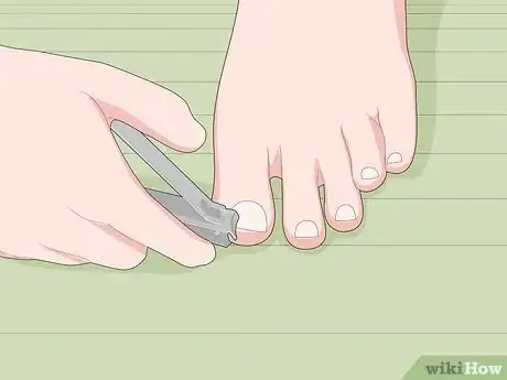 Image titled Prevent Ingrown Nails Step 10