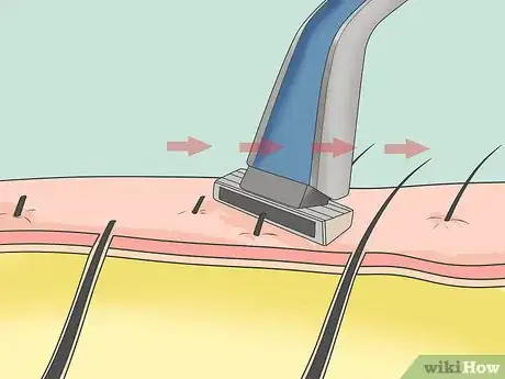 Image titled Shave Your Bikini Line Step 7