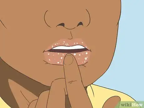 Image titled Stop Picking Your Lips Step 3