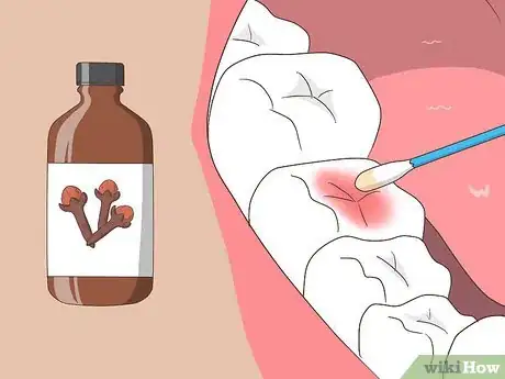 Image titled Cure a Toothache Step 10