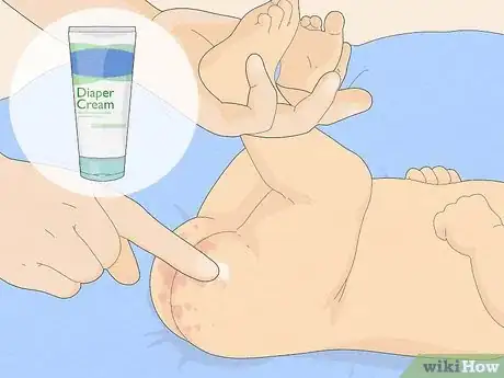 Image titled Treat Diaper Rash Step 3