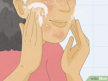 Image titled Treat Face Eczema Step 2