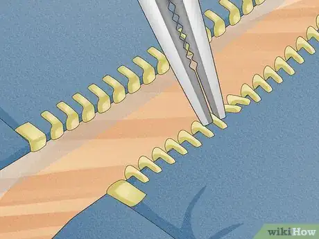 Image titled Fix a Separated Zipper Step 2