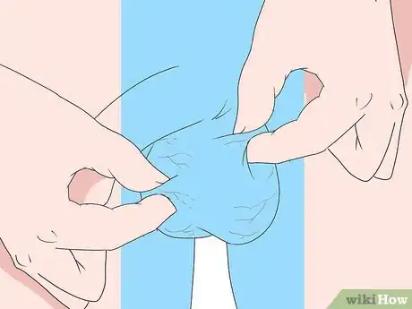 Image titled Diagnose Testicular Cancer Step 2