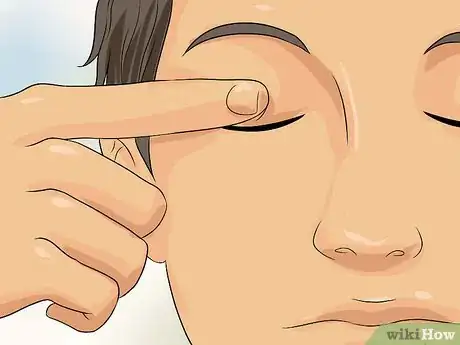 Image titled Remove Stuck Contact Lenses Step 5