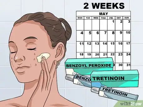 Image titled Use Tretinoin and Benzoyl Peroxide Concurrently Step 1