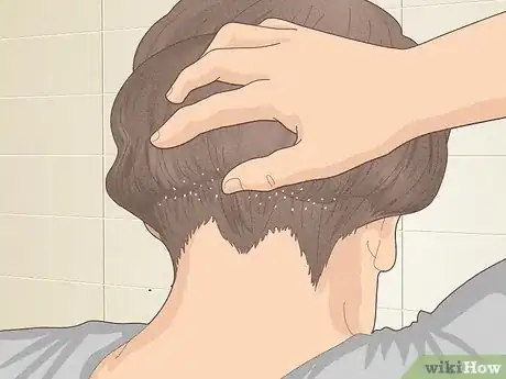 Image titled Bumps on Scalp Step 5