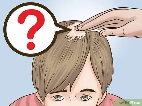 Image titled Stop Hair Loss in Children Step 2