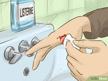 Image titled Stop Bleeding Step 10