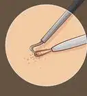 Close Blackhead Holes