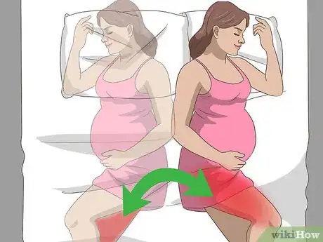 Image titled Relieve Sciatica Pain During Pregnancy Step 1