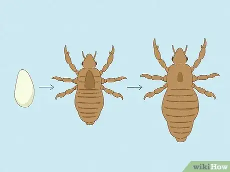 Image titled Treat Crabs (Pubic Lice) Step 1