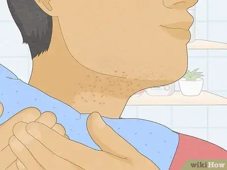 Image titled Get Rid of Razor Bumps on Your Neck Step 1