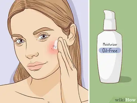 Image titled Treat Oily Skin with Large Pores Step 3