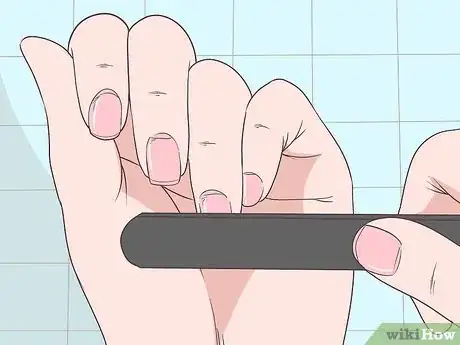 Image titled Get Rid of Psoriasis on Your Nails Step 12