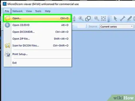 Image titled Open a DICOM File on PC or Mac Step 17