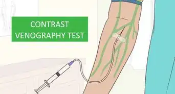 Treat DVT in Your Arm