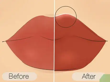 Image titled Get Gorgeous, Plump Lips Step 12