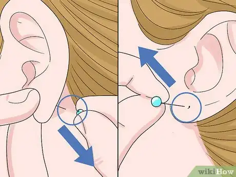 Image titled Remove Earrings for the First Time Step 5