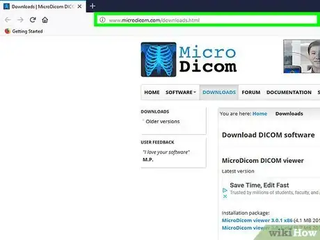 Image titled Open a DICOM File on PC or Mac Step 12