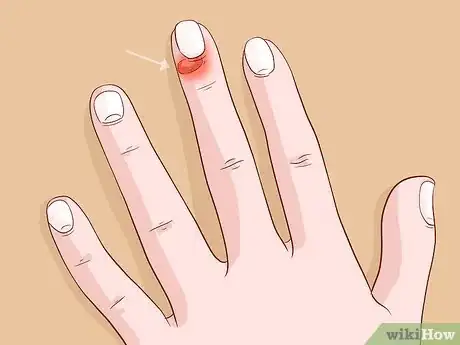 Image titled Care for Your Nails Step 10