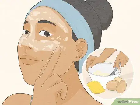 Image titled Use Eggs for Beautiful Skin and Hair Step 3