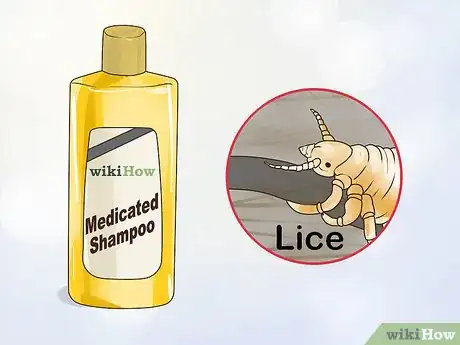 Image titled Get Rid of an Itchy Scalp Step 6