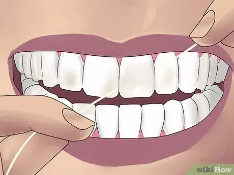 Image titled Get Perfect Teeth Step 4