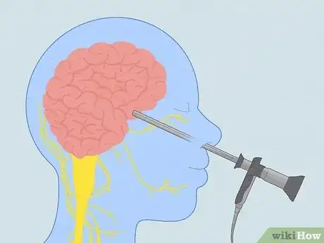 Image titled Lower Prolactin Levels Step 2