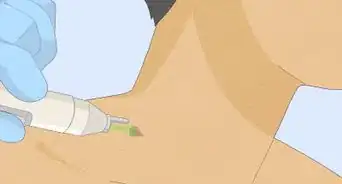 Remove a Skin Tag from Your Neck