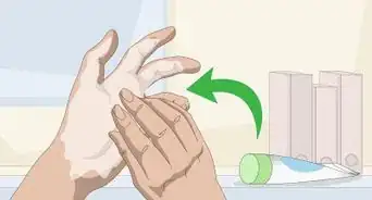 Heal Dry Cracked Hands