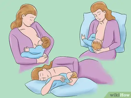 Image titled Breastfeed After a Cesarean Section Step 17