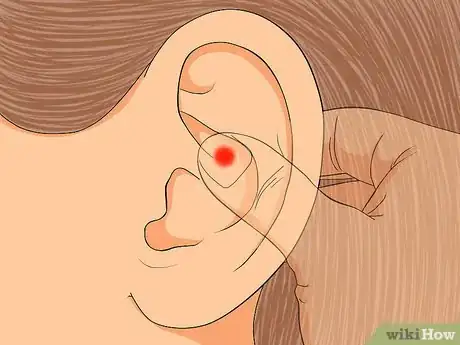 Image titled Apply Reflexology to the Ears Step 7