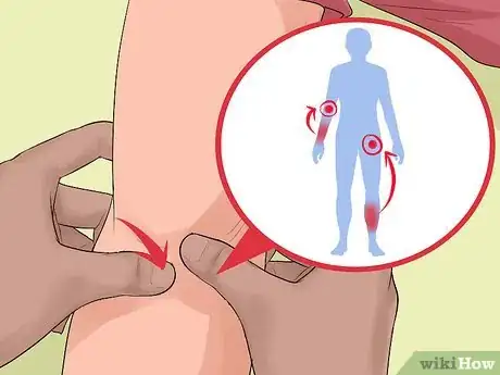 Image titled Treat Severe Bleeding During First Aid Step 8