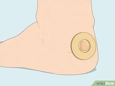 Image titled Apply Different Types of Bandages Step 16