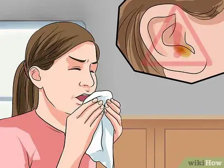 Image titled Know if You Have Otitis Media Step 24