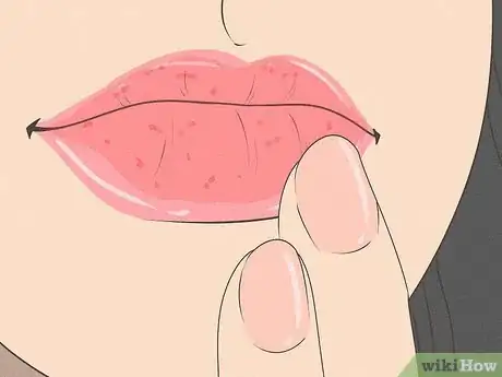 Image titled Get Kissable Lips Step 3