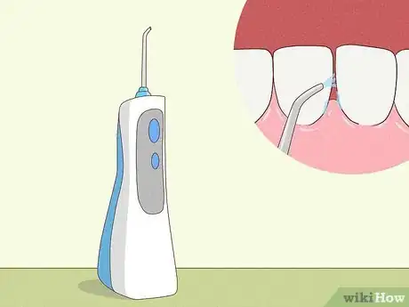 Image titled Brush Teeth Without Toothpaste Step 6