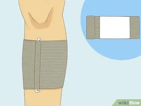 Image titled Apply Different Types of Bandages Step 18