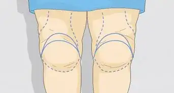 Get Rid of Knee Fat