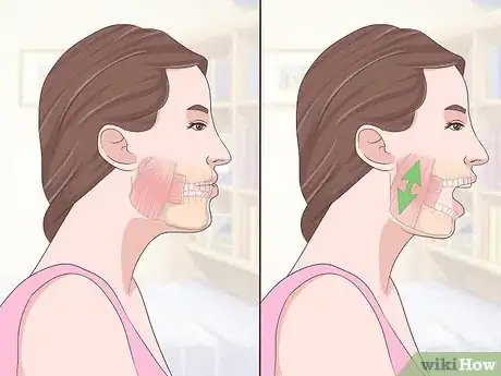 Image titled Treat Temporomandibular Joint Disorder (TMD) with Jaw Exercises Step 5