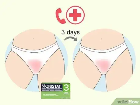 Image titled Apply Monistat Step 4