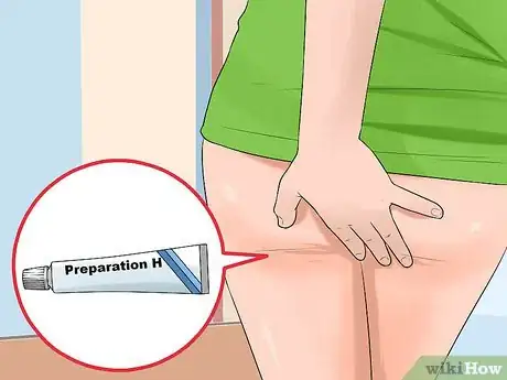 Image titled Stop Hemorrhoids from Itching Step 4