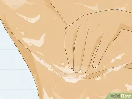 Image titled Clean Your Elbows Step 1