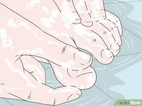 Image titled Remove Splinters from Feet Step 7