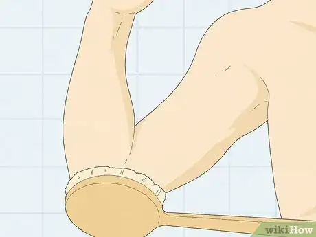 Image titled Clean Your Elbows Step 2